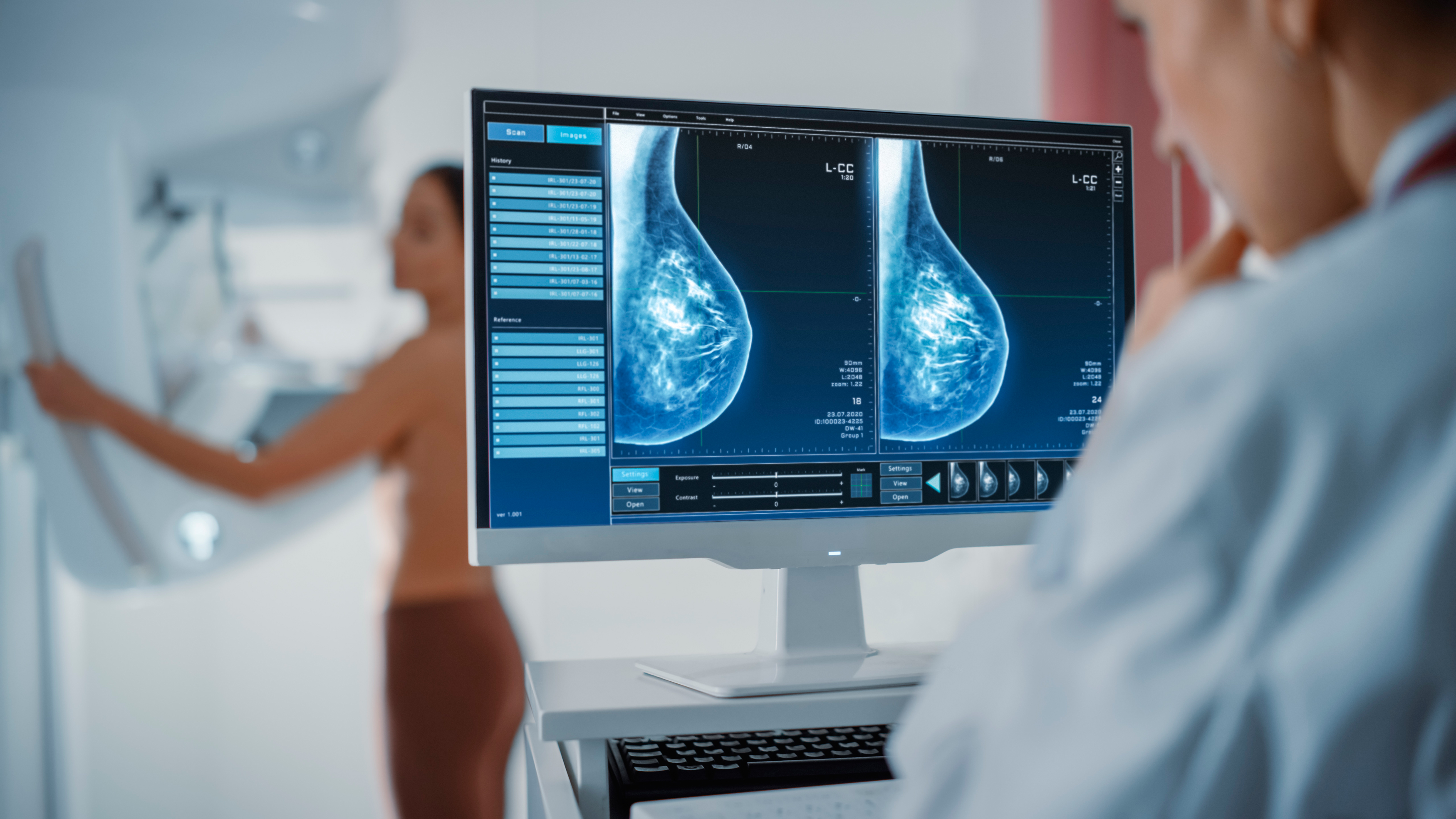 Mammographie Diagnostik Neuwied